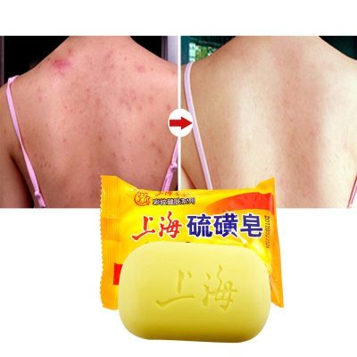 Shanghai sulfur soap oil-control acne treatment blackhead remover soap 90g Whitening cleanser Chinese traditional Skin care  Stirmas
