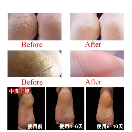 Snake Oil Tender Hand Cream Hand Care Antibacterial Anti-chapping Whitening Nourishing Anti-Aging Skin Care Cream 80g  Stirmas