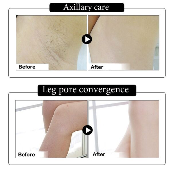 Body Armpit Whitening Cream Skin Care Between Legs Knees Private Parts Whitening Formula Armpit Whitener Intimate  Stirmas